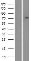 SSX2IP Protein (Over-Expression Lysate Myc-DDK (Flag))