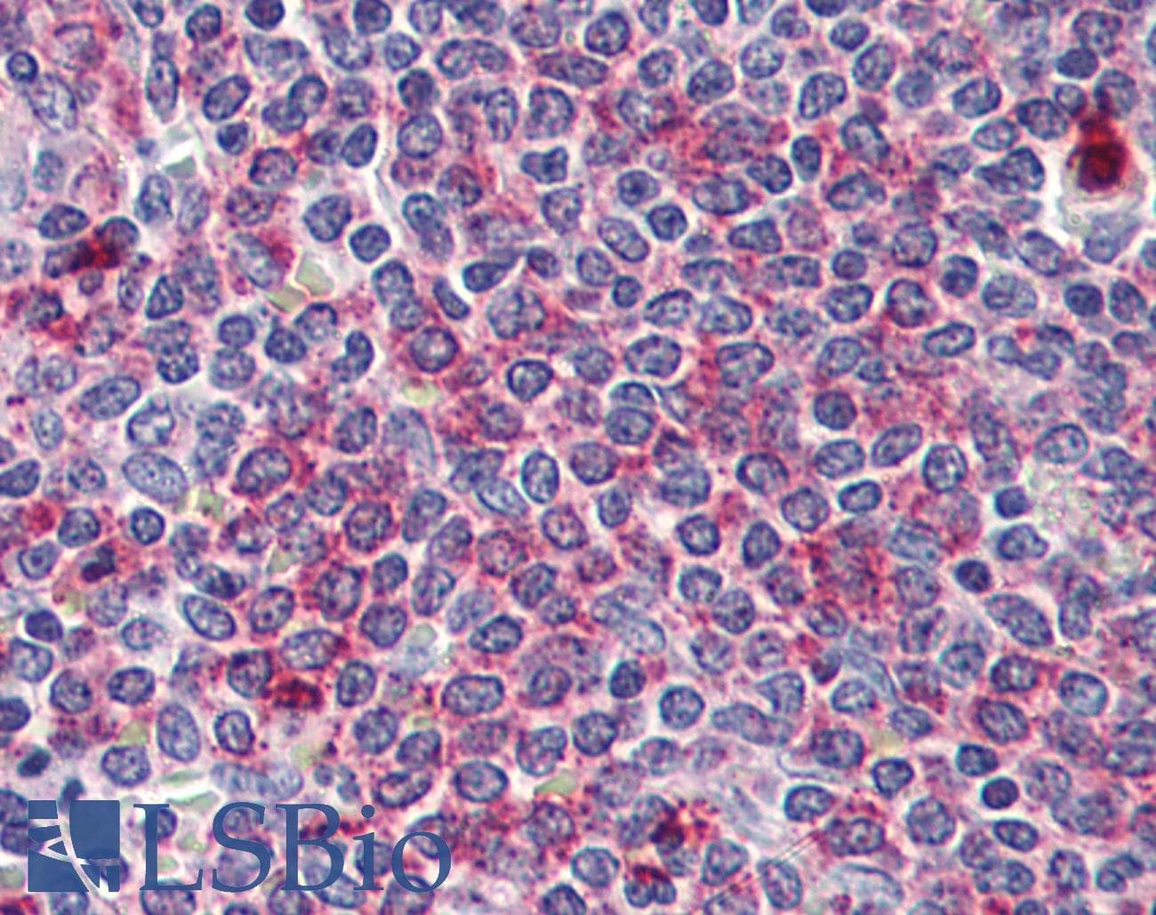 IHC-plus™ WNT5B Antibody (Internal)