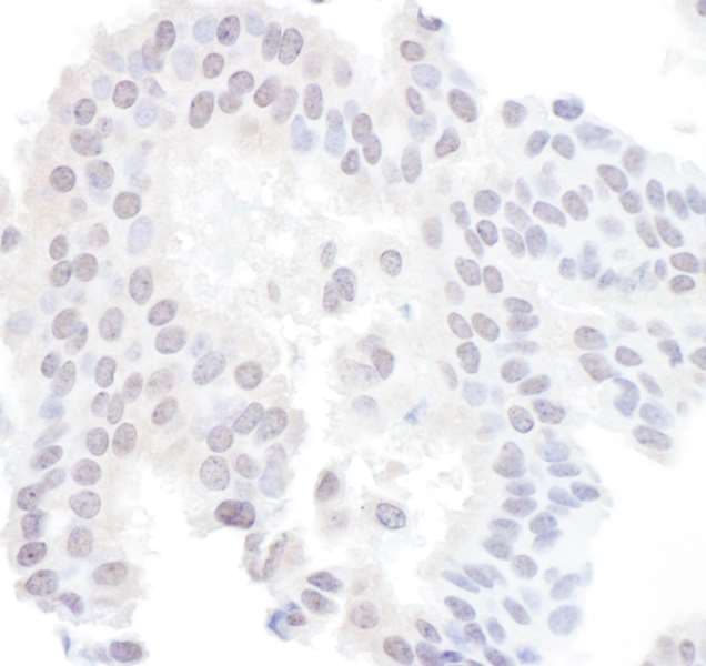 Polyclonal Rabbit anti-Human SAE1 Antibody (aa296-346, IHC)