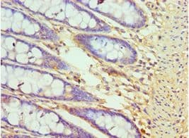 Polyclonal Rabbit anti-Human CXXC1 / CGBP Antibody (aa1-210, IHC, WB)
