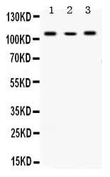 ACTN4 Antibody