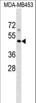 MR1 Antibody (aa312-341)