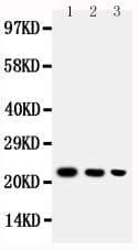 BAFF / TNFSF13B Antibody (aa265-285)