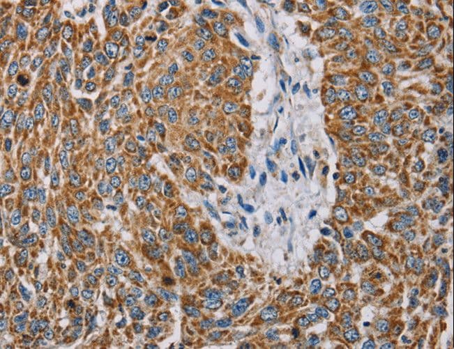 MTFP1 Antibody