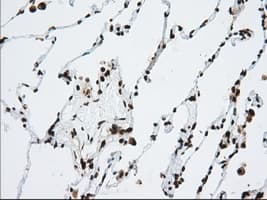 ERIC-1 / TACC3 Antibody (clone OTI1E8)