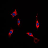 Rho Kinase / ROCK1 Antibody (Internal)