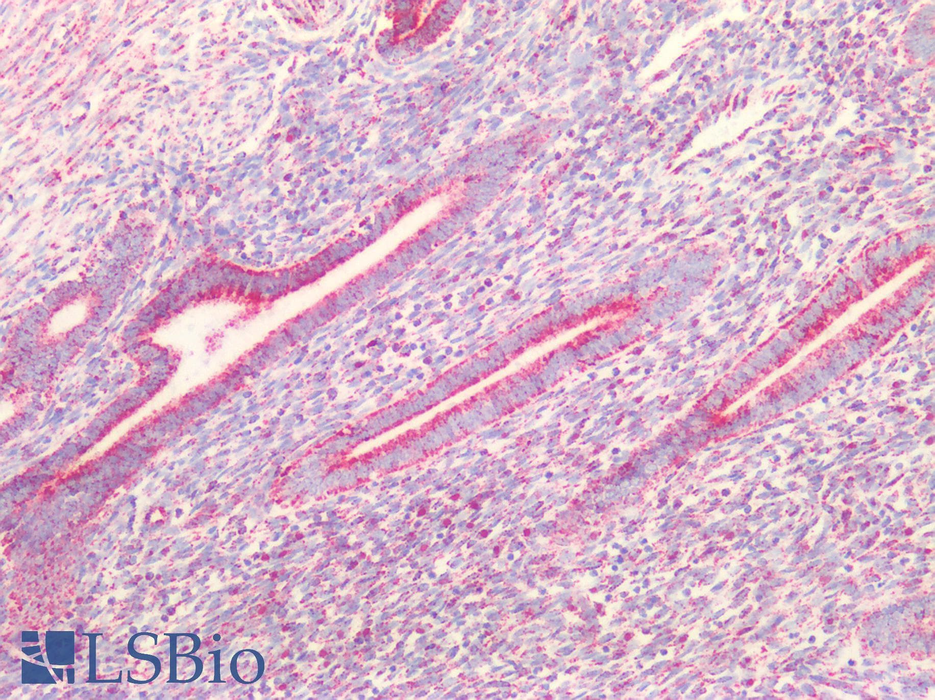 PathPlus™ PVR / CD155 Antibody (aa314-342)
