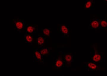 Polyclonal Rabbit anti-Human IRX2 Antibody (IHC, IF, WB)