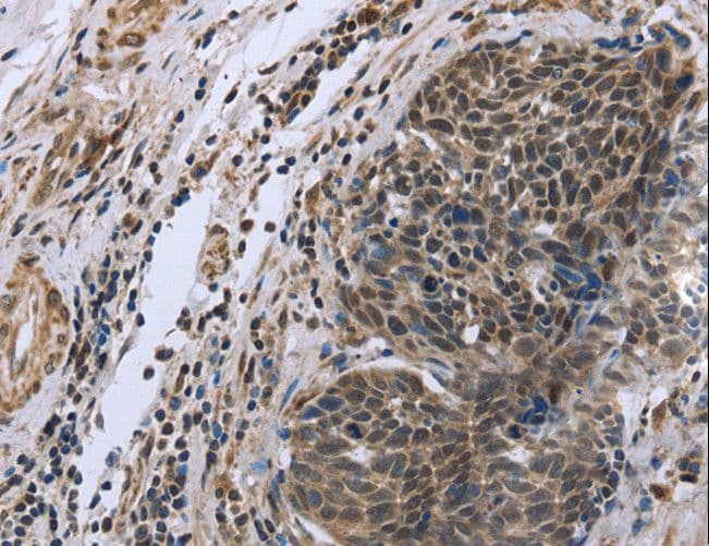 FANCG Antibody