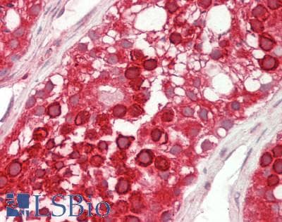 USP2 Antibody (aa371-420)