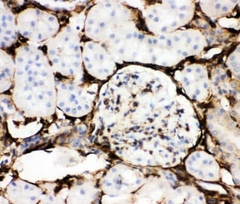 ANXA5 / Annexin V Antibody (aa2-320)