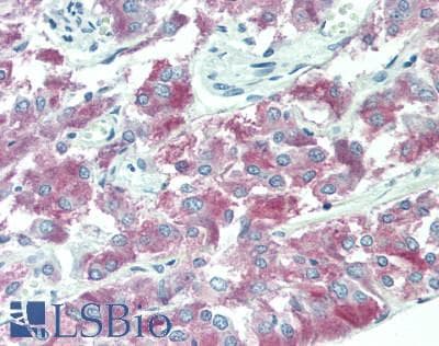 IHC-plus™ TRIM21 / RO52 Antibody (aa425-475)