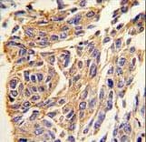PPT1 / CLN1 Antibody (aa269-300)