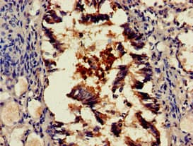 Polyclonal Rabbit anti-Human SCTR / SR / Secretin Receptor Antibody (IHC, IF)
