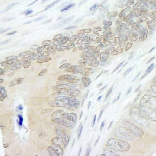 HUWE1 / ARFBP1 Antibody (aa2250-2300)