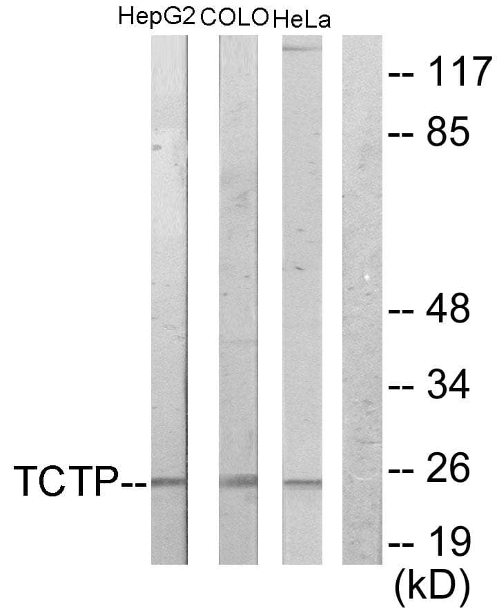 Polyclonal Rabbit anti-Human TPT1 / TCTP Antibody (IHC, WB)
