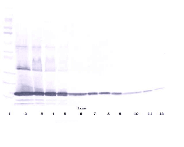Polyclonal Rabbit anti-Human TNF Alpha Antibody (Biotin, WB)