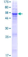 Human SLC22A24 Protein (Recombinant GST)