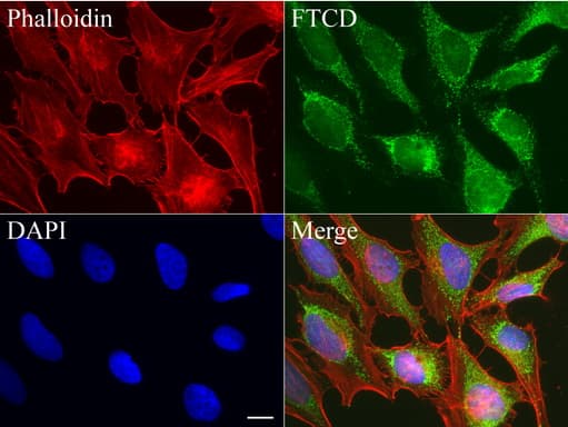 FTCD / 58K Golgi Protein Antibody (clone UMAB122, Carrier-free)