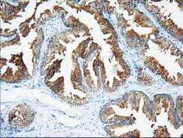 XPNPEP1 / Aminopeptidase P Antibody (clone OTI1E3)