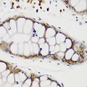 NCL / Nucleolin Antibody