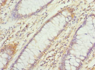 Polyclonal Rabbit anti-Human HDS / DHDDS Antibody (IHC)