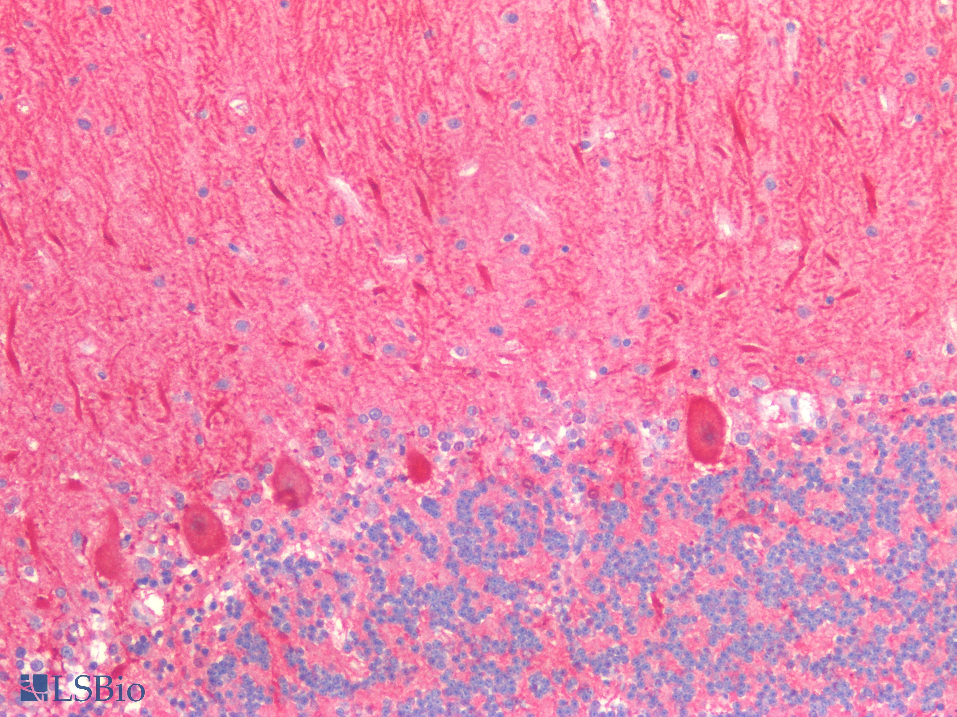 PathPlus™ NTRK3 / TRKC Antibody (C-Terminus)