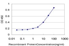 DPP4 / CD26 Antibody (clone 1C5)