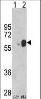 Polyclonal Rabbit anti-Human ARSB / Arylsulfatase B Antibody (aa235-266, WB)
