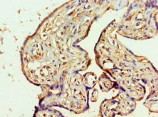 Polyclonal Rabbit anti-Human MTMR14 Antibody (aa1-280, IHC, WB)