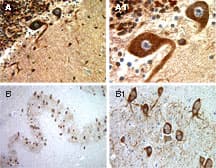 BAR / BFAR Antibody (aa1-139)