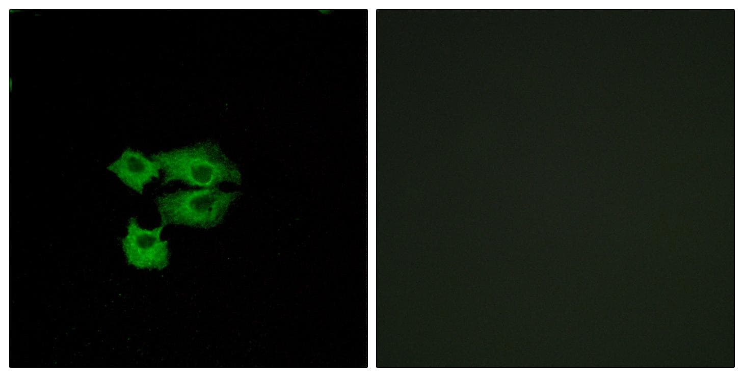 SCA2 / LY6E Antibody