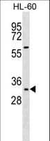 HOXB13 Antibody (aa92-121)