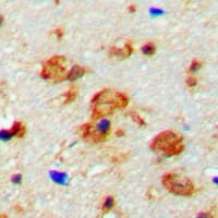 CaMKII Beta+Gamma Antibody (phospho-Thr287)