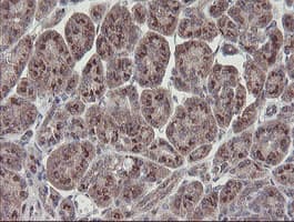 RBPMS / Hermes Antibody (clone OTI2C3, Carrier-free)