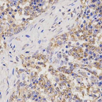 Polyclonal Rabbit anti-Human TNFRSF1B / TNFR2 Antibody (IHC, IF, WB)