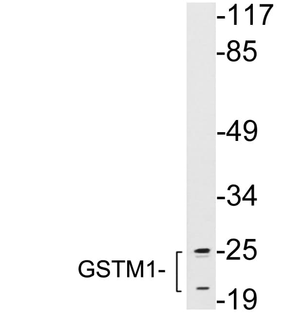 GSTM1 Antibody (aa101-150)