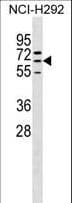 ZNF599 Antibody (aa32-59)