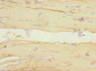 Polyclonal Rabbit anti-Human ADGRG6 / GPR126 Antibody (IHC)