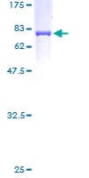 Human CKMT2 Protein (Recombinant GST)