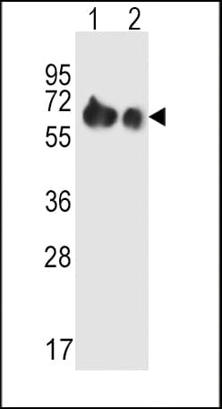 Polyclonal Rabbit anti-Human SLC3A2 / CD98 Heavy Chain Antibody (aa588-615, IHC, WB)