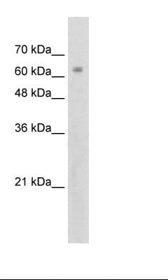 ZNF274 Antibody (aa87-136, Biotin)
