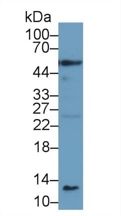 CASP1 / Caspase 1 Antibody (aa119-296, APC)