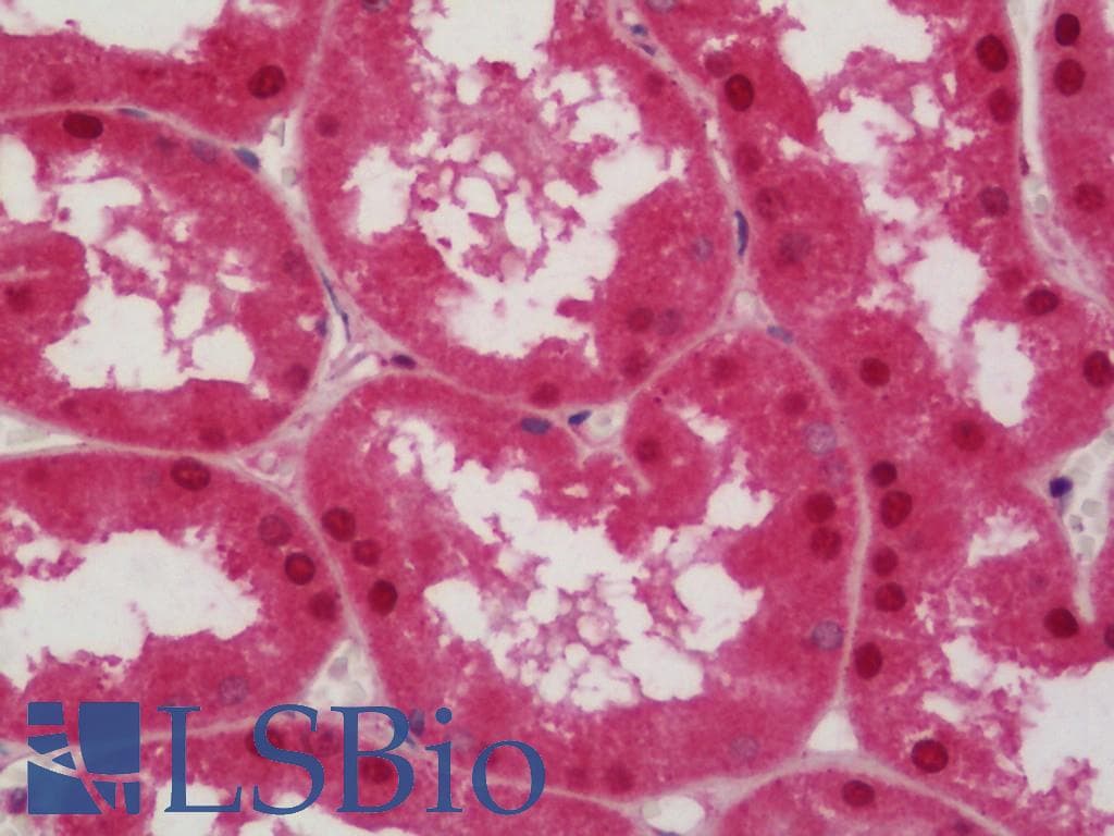 IHC-plus™ DIRAS3 / ARHI Antibody