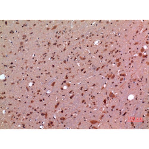 GDF5 / GDF-5 Antibody (351-400 aa, Internal)