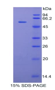Rabbit TFPI / LACI Protein (Recombinant His-GST)
