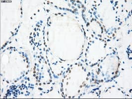 CRYAB / Alpha B Crystallin Antibody (clone OTI6G5)