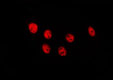 TOR1AIP1 / LAP1 Antibody