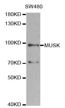 MUSK Antibody
