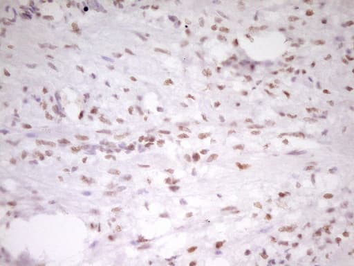 HMG20A Antibody (aa1-281, clone OTI2H4)